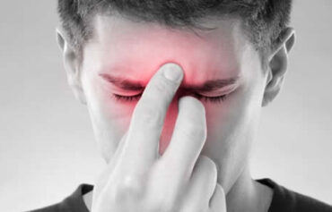 Sinusitis