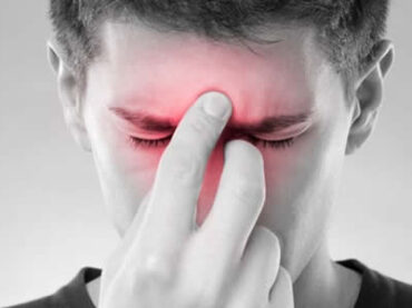 Sinusitis